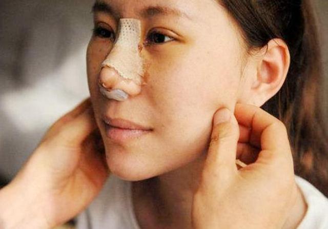 16岁女孩整容上瘾，光是在脸上3年整了近百次，老师：已无童真