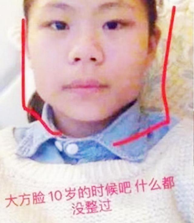 16岁女孩整容上瘾，光是在脸上3年整了近百次，老师：已无童真