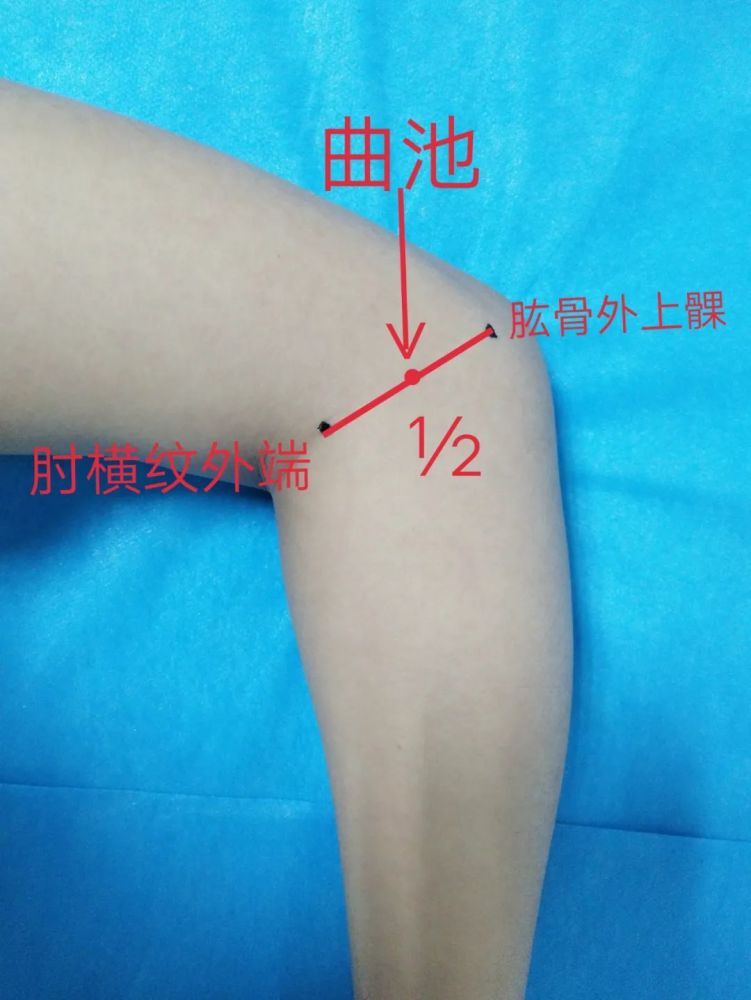 荨麻疹痒到生无可恋？试试艾灸曲池穴
