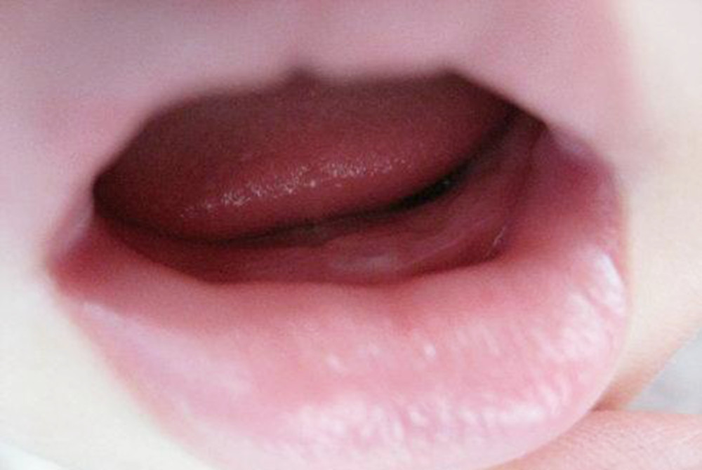 比如:有些宝宝8-11个月的时候长牙齿,有些宝宝会在12个月的时候长牙齿