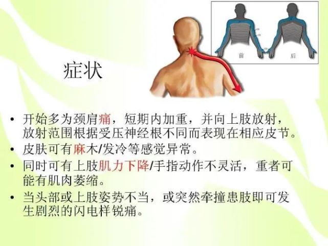 颈椎病的病因,一目了然,图解析