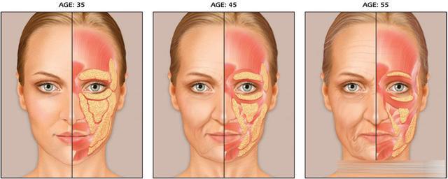 面部肌肉脂肪的衰老