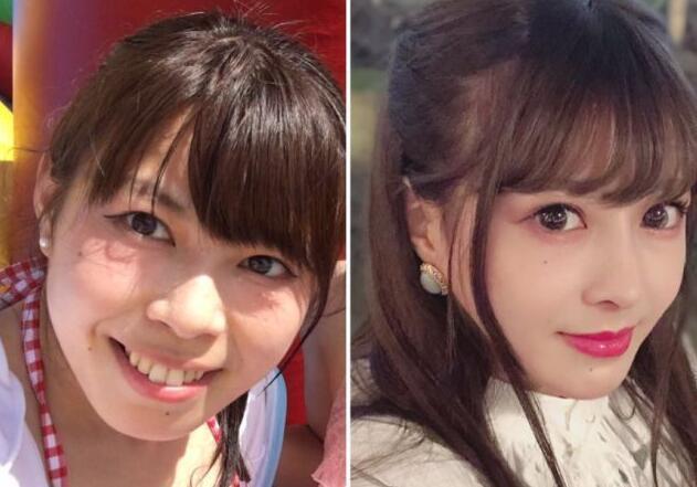 女生嫌长得丑花700万整容,从丑女逆袭成女神,网友:颜值绝了