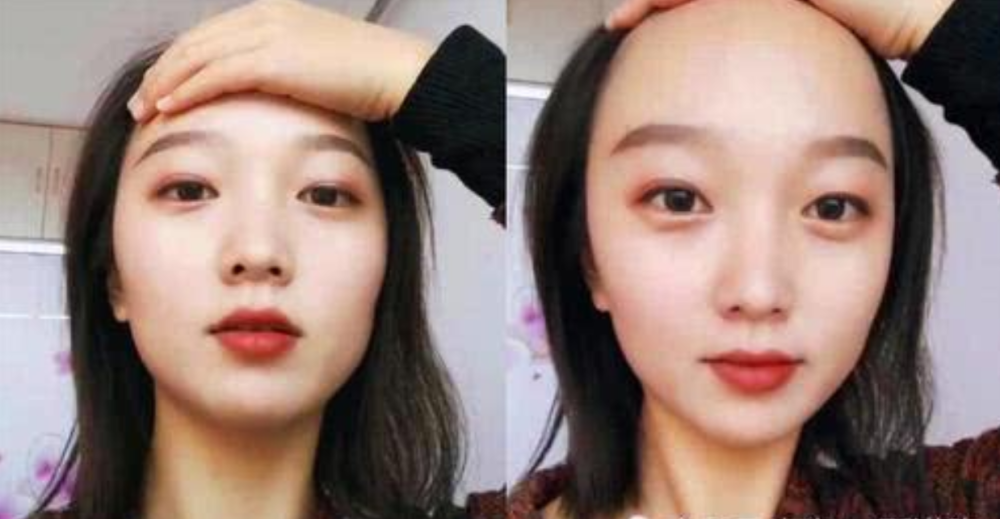 小仙女请注意,这3种发型留久了,"发际线"会悄悄上移,特别是第二!