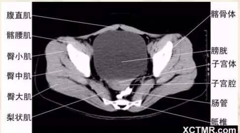 收藏必备|胸,腹,盆腔 ct解剖详解