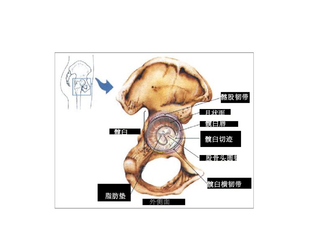 造成关节囊撕裂及圆韧带断裂的,这样就有可能会影响股骨头的血液运行