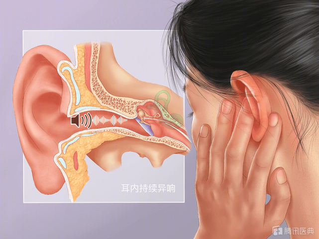 总听见敲击声让人烦躁不安可能是得了搏动性耳鸣这3个方法可缓解