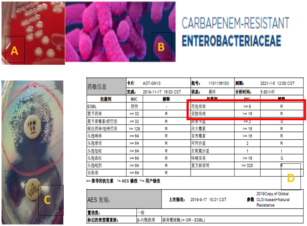 产酸克雷伯菌,奇异变形杆菌需要筛选产esbls菌株表型确证试验为阳性的