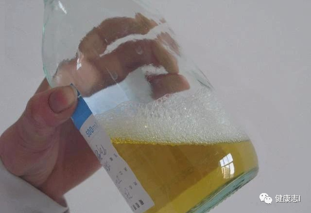 是否有尿毒症，喝点水就知道了，5大预防措施，教你远离疾病