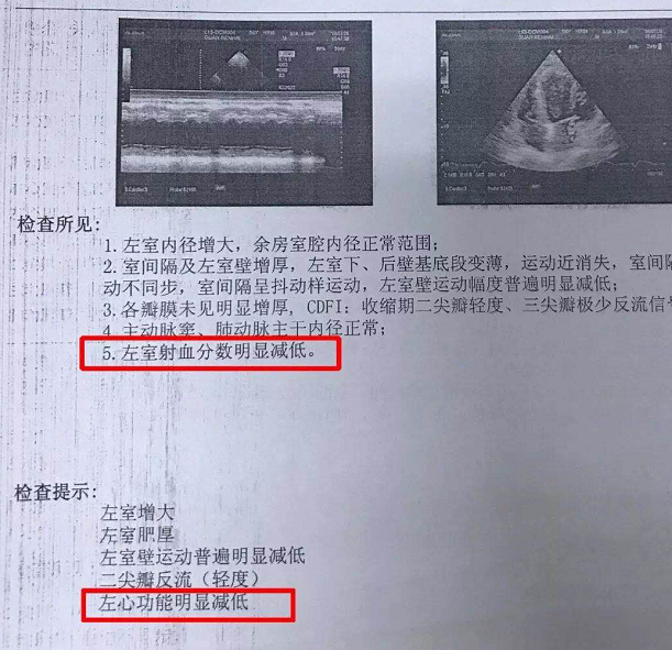 详解心脏彩超报告中的"射血分数"!