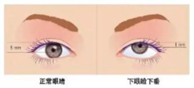 一张漂亮的脸绝对少不了一双美丽的大眼萌！