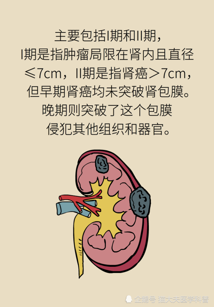 关于长在“腰子”上的癌，带你一文了解肾癌这名“沉默杀手”