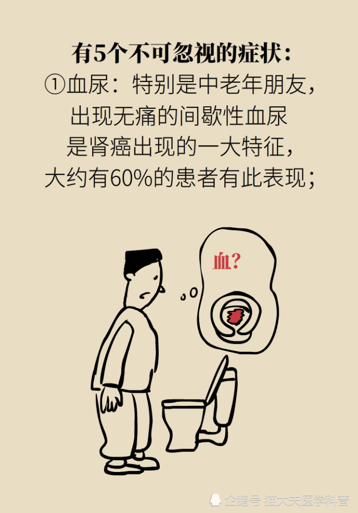 关于长在“腰子”上的癌，带你一文了解肾癌这名“沉默杀手”