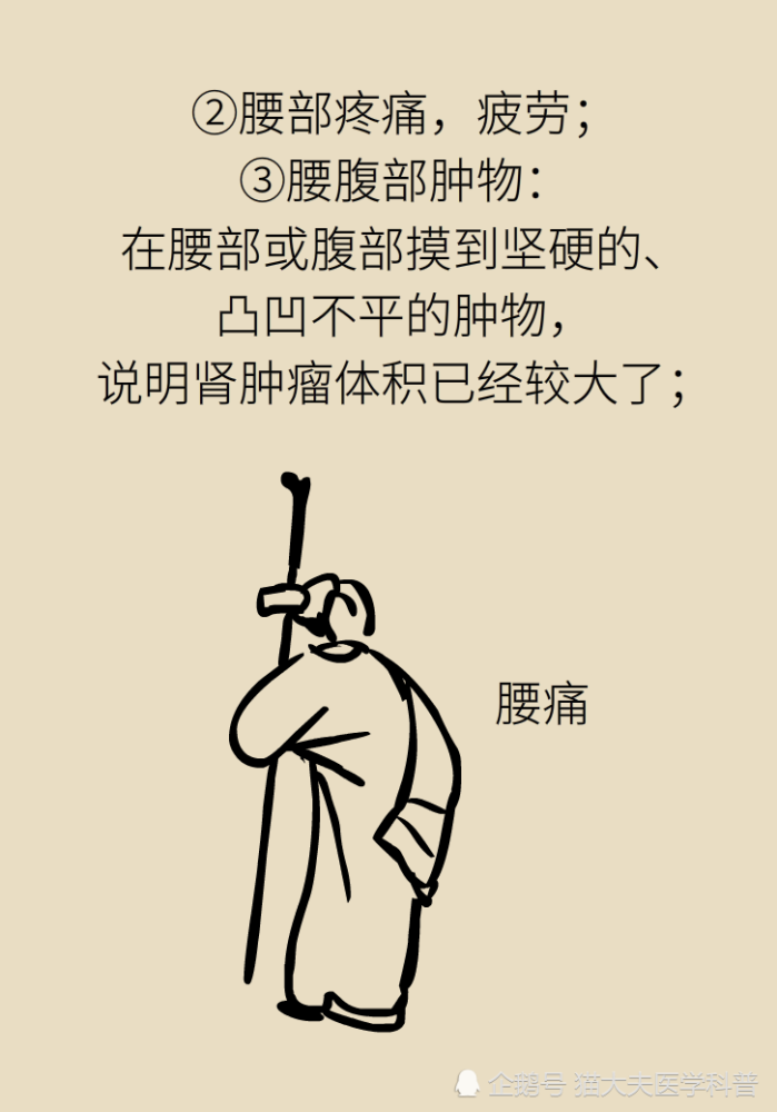 关于长在“腰子”上的癌，带你一文了解肾癌这名“沉默杀手”