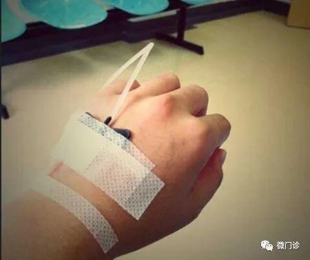 中医经方惹不起！四味药，两天拿下重感冒，外国人开眼了