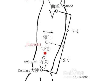 每日一穴【郄门穴】,宽胸利膈,心脏问题重要穴