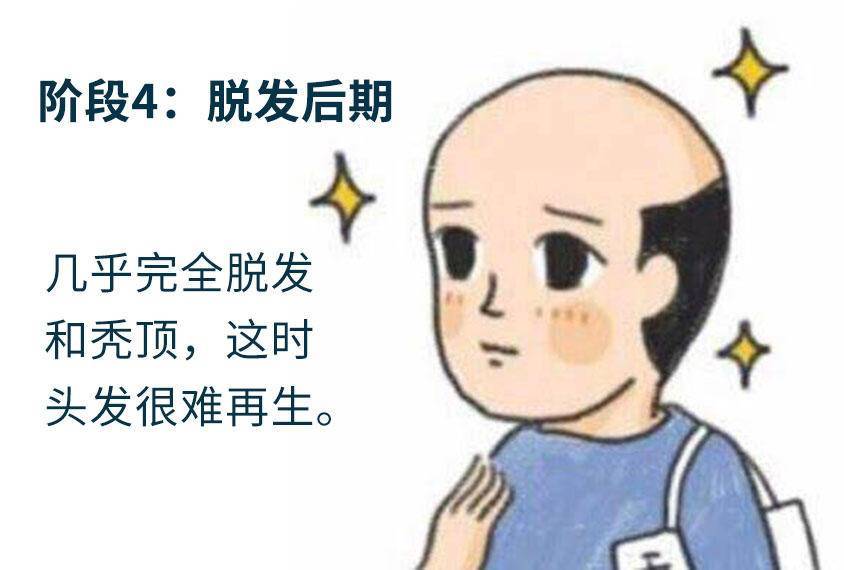 在脱发的每个阶段你的头发还有救吗