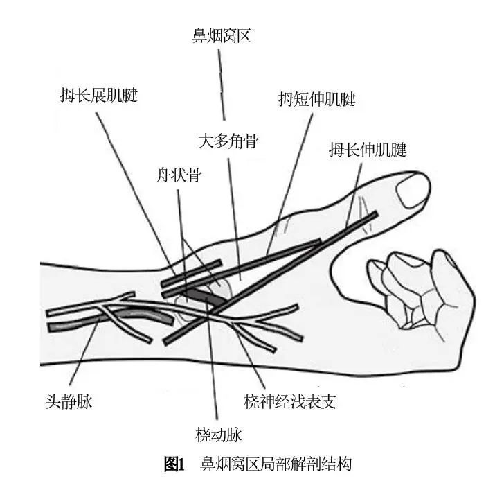 使患者充分伸展拇指,在拇长展肌,拇短伸肌和拇长伸肌肌腱之间可见一