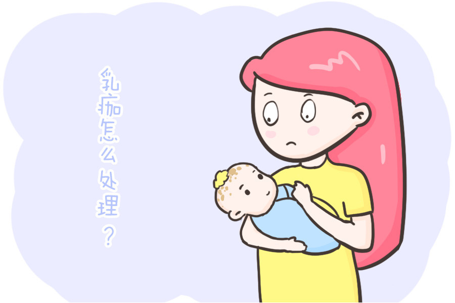 怎么处理宝宝出生后头部的乳痂？一篇帮你答疑解惑，父母快收藏吧