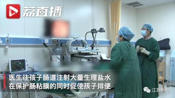 肠镜发现,孩子的直肠里有一个较大的粪块,沿着肠道往上探查了40公分