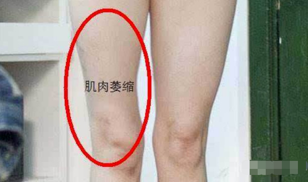 万茜骨折实锤！眼看就要成为顶流却瞬间凉凉！