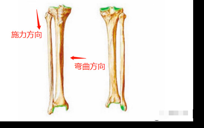 万茜骨折实锤！眼看就要成为顶流却瞬间凉凉！