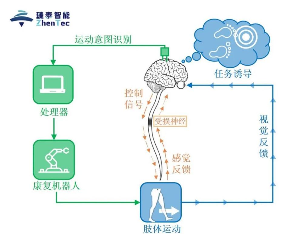 臻泰智能:瞄准康复领域刚需,发布"bci vr 机器人"脑机智能康复整体