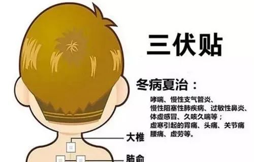 号外号外！湖北荆门一医康复科，三伏贴开始预约