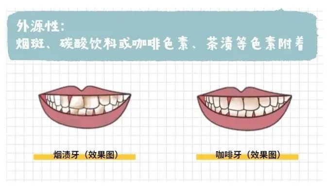 牙膏：虽然哥是化妆品，但不要再让我美白了