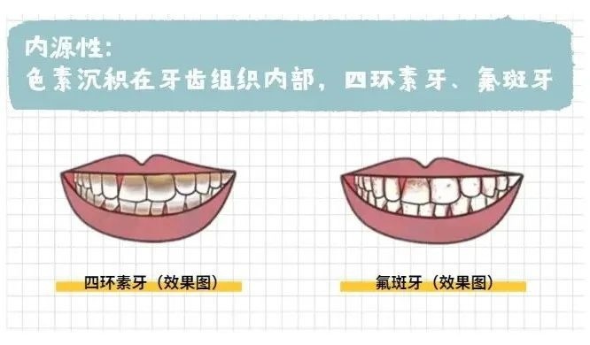 牙膏：虽然哥是化妆品，但不要再让我美白了