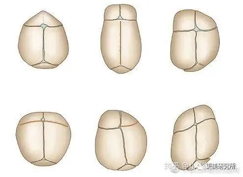 亚洲第一换头宝，50年前就整成芭比，因插足被原配砍？