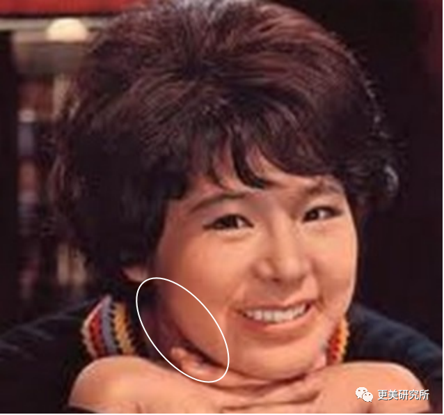 亚洲第一换头宝，50年前就整成芭比，因插足被原配砍？