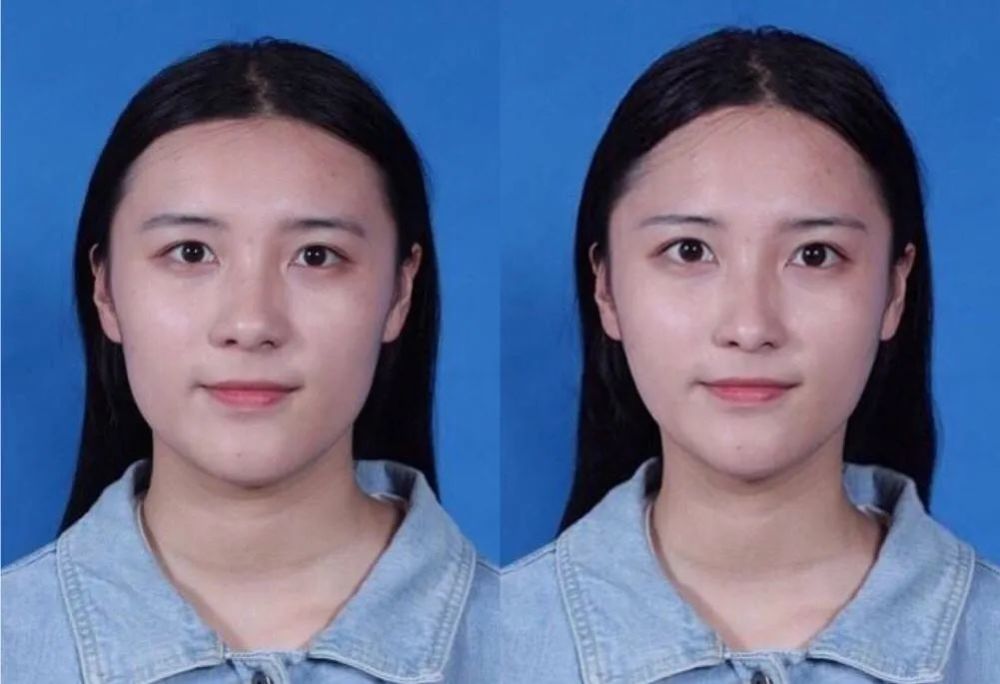 亚洲第一换头宝，50年前就整成芭比，因插足被原配砍？