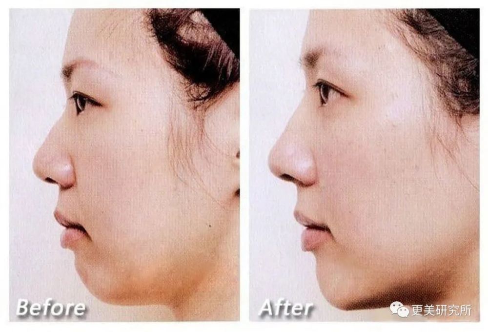 亚洲第一换头宝，50年前就整成芭比，因插足被原配砍？