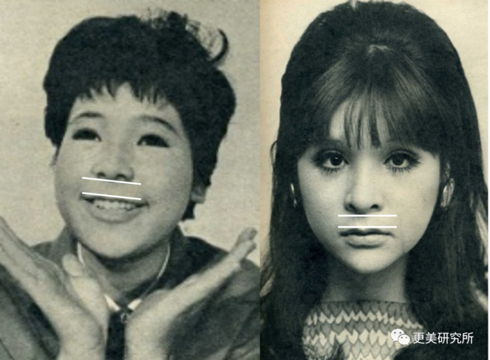 亚洲第一换头宝，50年前就整成芭比，因插足被原配砍？