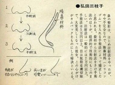 亚洲第一换头宝，50年前就整成芭比，因插足被原配砍？