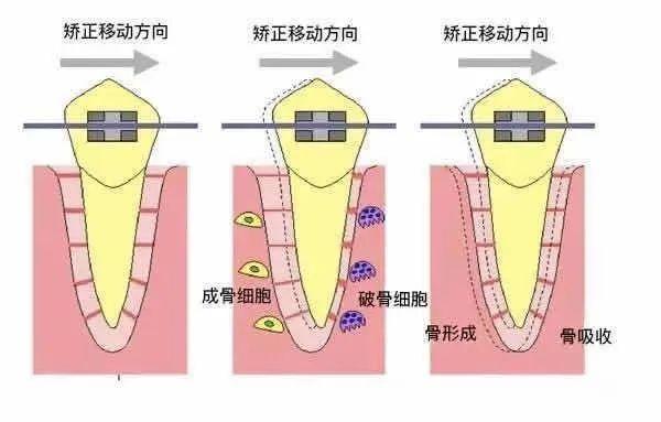 暑假＋？＝颜值逆袭这题你不会？你对正畸的力量一无所知