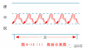 疾脉:快过数者脉名疾,载阳又可阳凶升.