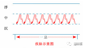紧脉:数又弦疾和成紧,举如转索切绳形.