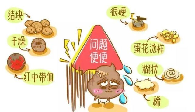 一旦大便变细,或呈扁条状,槽沟状,细条状,前头干硬,后边软粘等.