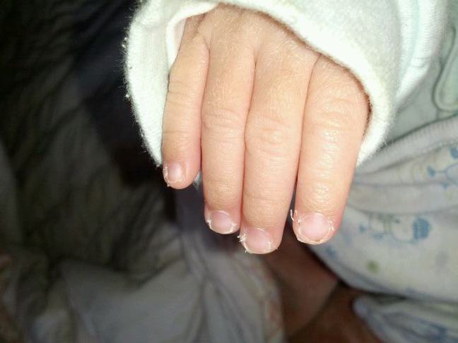 孩子啃指甲是缺维生素?两大心理因素有关系,2岁后还啃