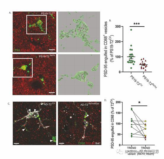 小鼠实验一致,表达突变体trem2的患者脑部的cd68 吞噬小泡中的psd-95