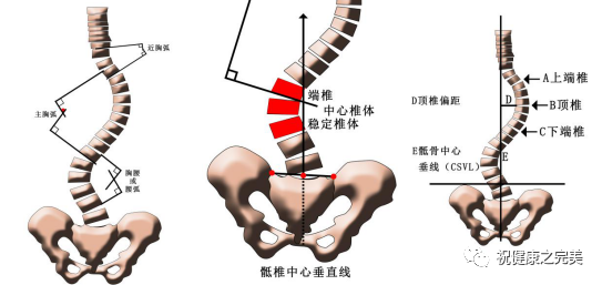 全脊柱矢状面平衡:失平衡程度:a-b.