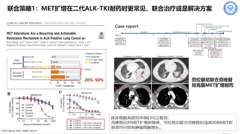 肺癌靶向药二代alk抑制剂耐药后怎么办?七大攻略集锦!