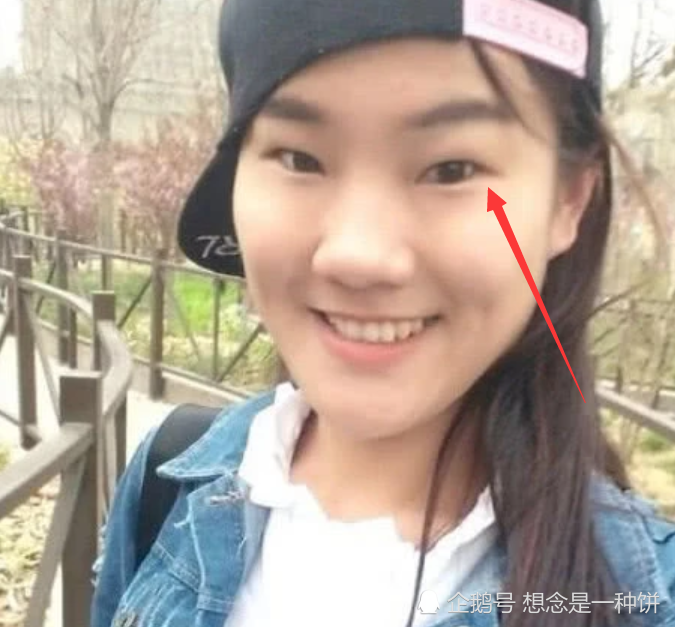 眯缝眼