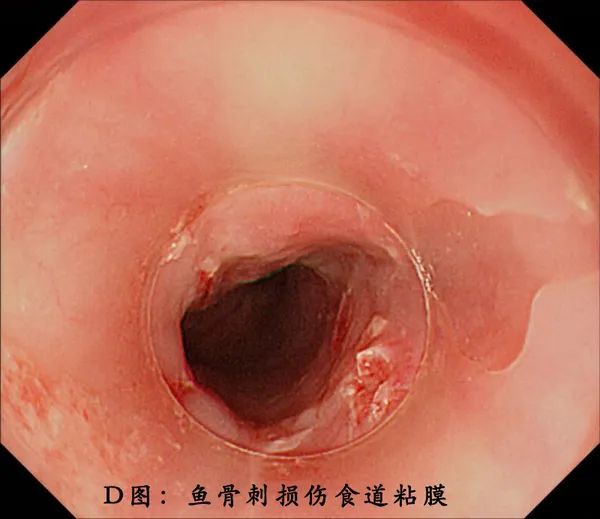 老人口中出血_手出血图片(3)