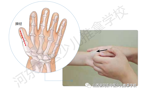 1 虚寒型 一,补脾经 精准定位:拇指桡侧缘指尖到指根成一直线.