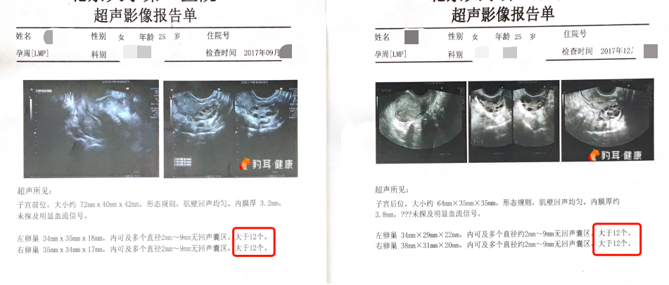 吃中药调经，结果西医大夫说：“别吃了，根本没用”