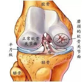 10天不运动，身体变了样！不爱运动的早亡风险比喝酒吸烟还高