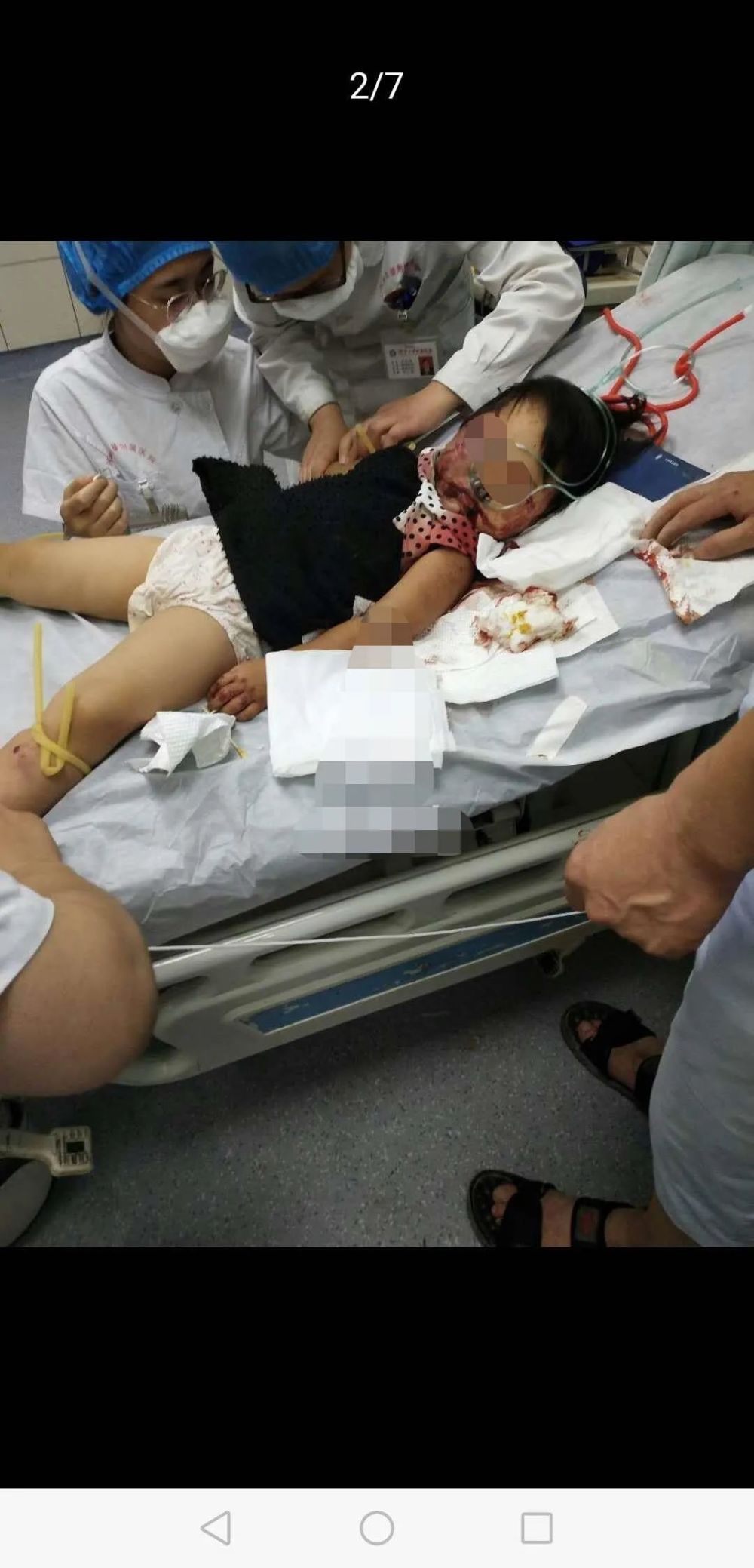 男子用铁锨行凶致1死1伤后自杀